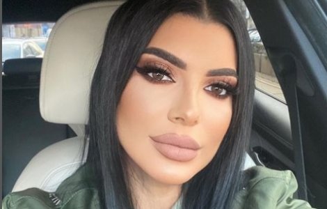 Ce probleme are Andreea Tonciu, după ce a participat la Survivor România: „Am început deja tratamentul”