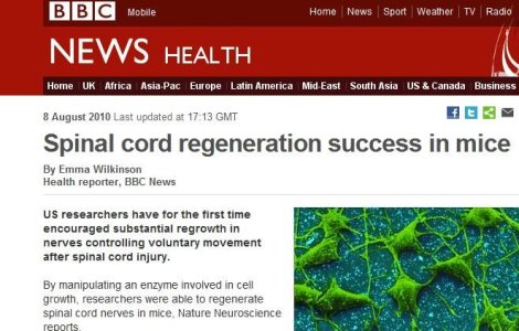 Regenerarea nervilor spinali este posibila