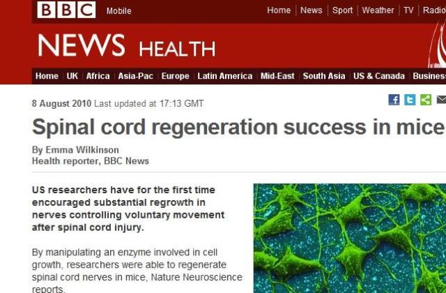 Regenerarea nervilor spinali este posibila
