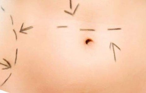  Top  Tinerete fara batranete prin automutilare: Celebritati dependente de chirurgie plastica