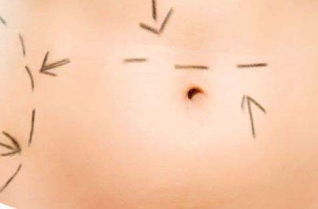 Tinerete fara batranete prin automutilare: Celebritati dependente de chirurgie plastica