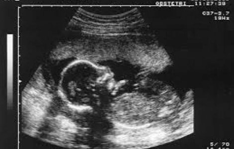 UK: Fetusi avortati, arsi si folositi pentru incalzirea spitalelor