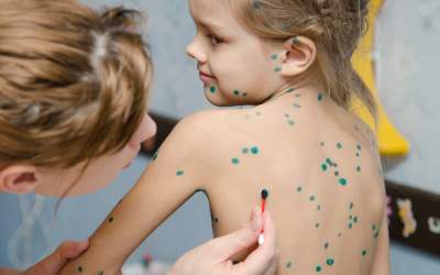 Explozie de cazuri de...