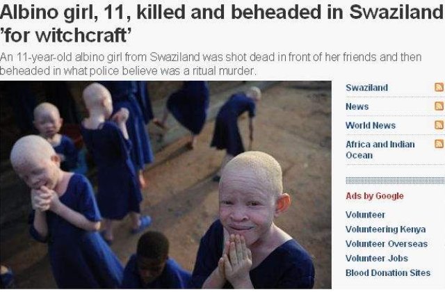 Swaziland: O fetita albinoasa, decapitata de vrajitori