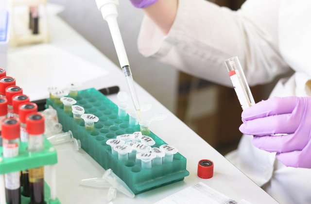 Bilanț COVID-19, 22 aprilie 2022. Au fost înregistrate 974 de cazuri noi 