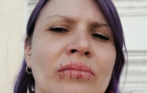 Și-a cusut gura în semn de protest față de războiul din Ucraina
