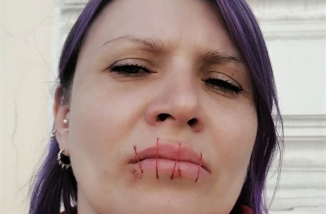 O activistă din Rusia și-a cusut gura în semn de protest față de războiul din Ucraina