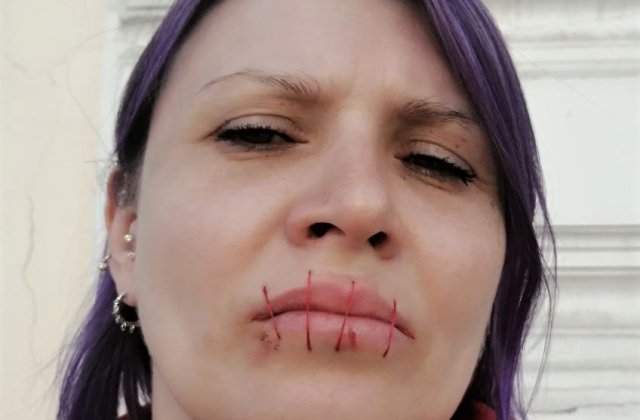 O activistă din Rusia și-a cusut gura &icirc;n semn de protest față de războiul din Ucraina