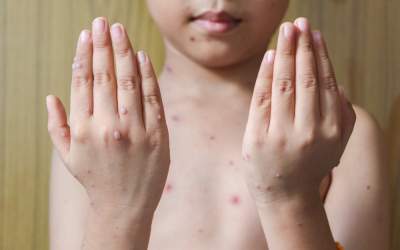 Slovenia a înregistrat primul...