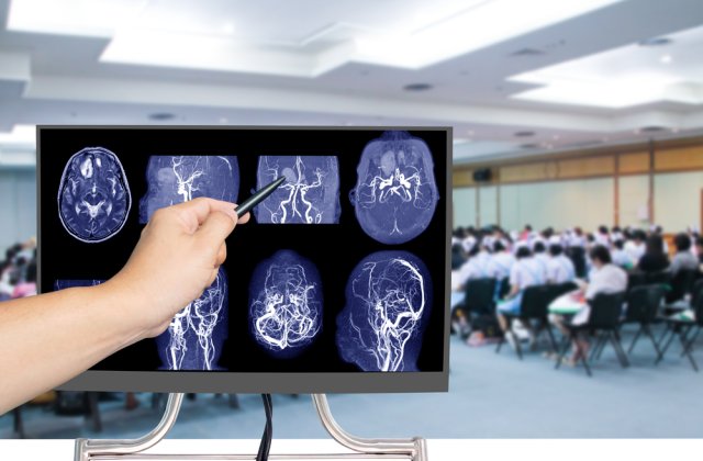 Caz bizar la un liceu din SUA. Peste 100 de elevi au făcut o formă rară de cancer la creier