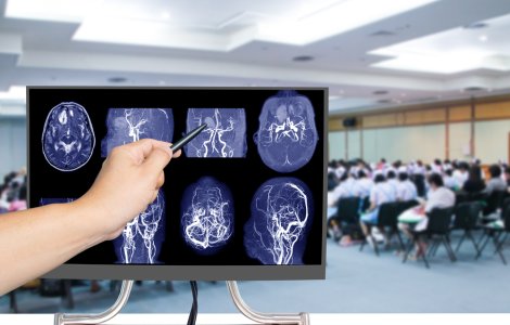 Caz bizar la un liceu din SUA. Peste 100 de elevi au făcut o formă rară de cancer la creier