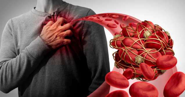 Simptome că un cheag blochează circulația sângelui în diverse părți ale corpului