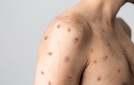 Ce spune Ministerul Sănătății despre starea pacientului