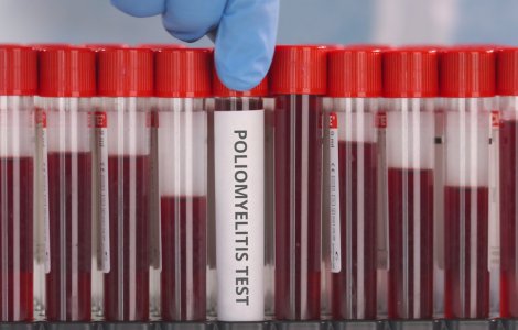 Virusul care cauzează poliomielita a fost depistat în canalizare la Londra