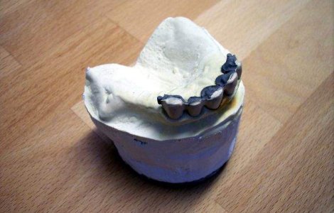 Raze laser de mica intensitate, utilizate pentru regenerarea dintilor