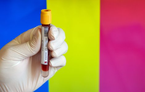 Ministerul Sănătății a decis să revină la bilanțul zilnic COVID-19