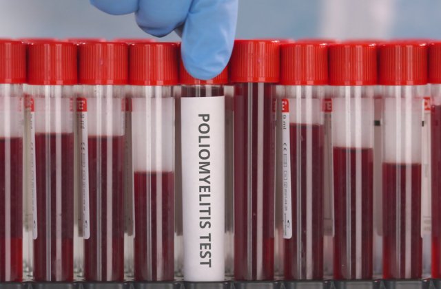 &Icirc;n New York s-a raportat primul caz de poliomielită din SUA din ultimul deceniu