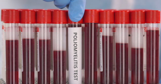 În New York s-a raportat primul caz de poliomielită din SUA din ultimul deceniu