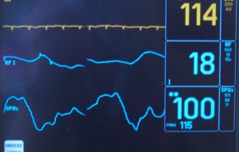 Tanarul rom agresat in Franta este in COMA profunda