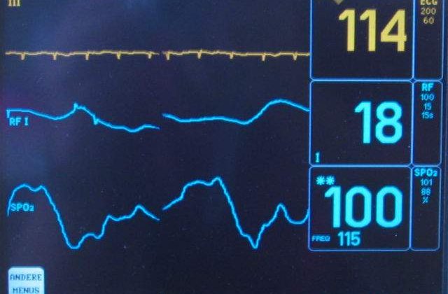 Tanarul rom agresat in Franta este in COMA profunda