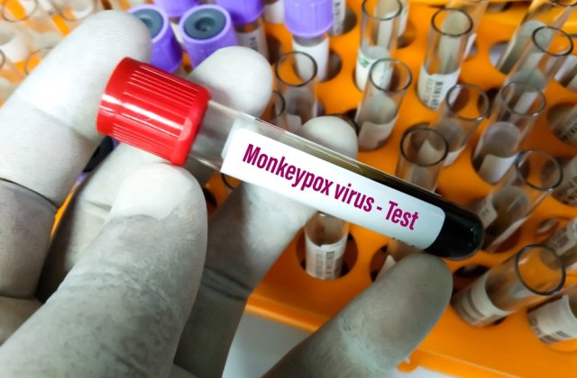 Țara &icirc;n care variola maimuței a fost declarată urgență medicală