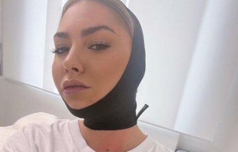 Jo s-a operat! La ce intervenție estetică a apelat artista: „Așa pentru sufletul meu”