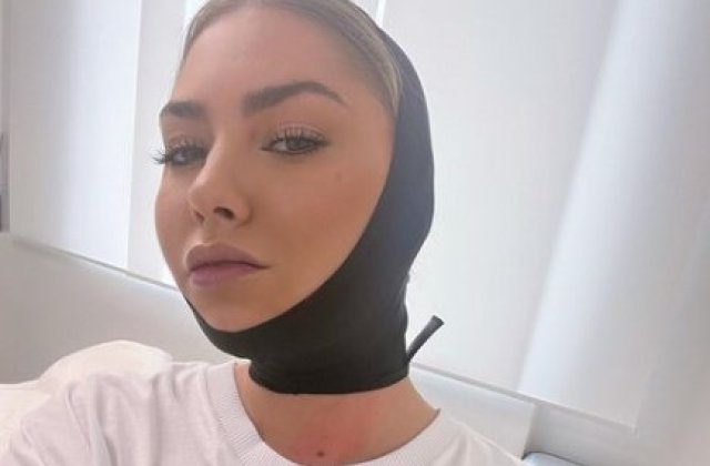 Jo s-a operat! La ce intervenție estetică a apelat artista: &bdquo;Așa pentru sufletul meu&rdquo;