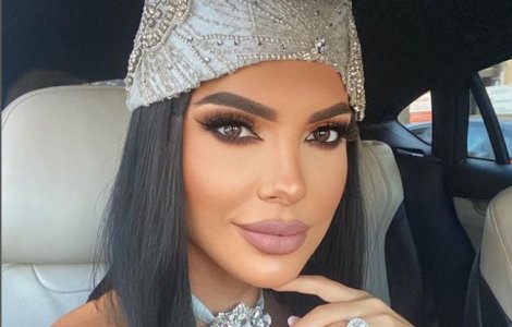 Andreea Tonciu, atac dur la adresa femeilor botoxate: „Nu se mai vede nasul, atâta aveți botul”