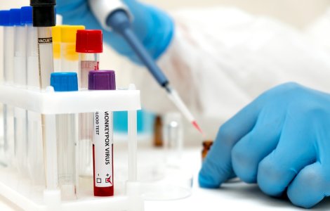 România raportează alte două cazuri de infectare cu variola maimuței