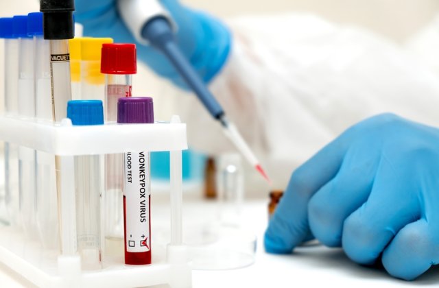 Rom&acirc;nia raportează alte două cazuri de infectare cu variola maimuței