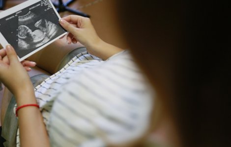 Mai multe ONG-uri cer Guvernului să deconteze avortul la cerere prin CNAS