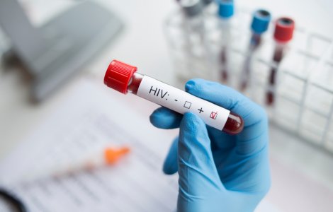 Testare gratuită pentru HIV și hepatita C. Unde te poți testa