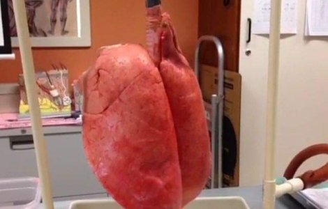  Video  Ce se intampla DE FAPT cu plamanii nostri atunci cand fumam