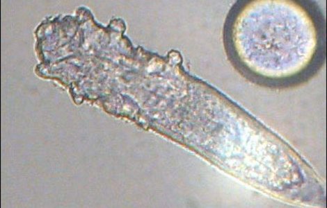  Foto  Aceste ANIMALE cu opt picioare traiesc pe FETELE OAMENILOR!