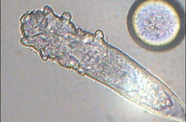 [FOTO] Aceste ANIMALE cu opt picioare traiesc pe FETELE OAMENILOR!
