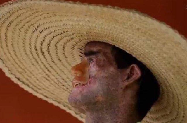 [VIDEO] BOALA NECRUTATOARE care distruge un sat din Brazilia!