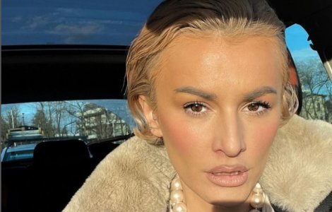 Ruxi s-a umplut de bube pe față. Cum și-a făcut vedeta apariția pe Instagram: „Din cauza frigului...”