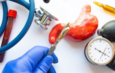 Bariatria: Despre operatie si beneficii