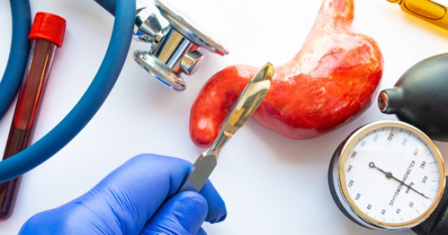 Bariatria: Despre operatie si beneficii