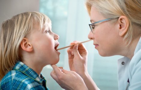 2 cauze comune ale apariției amigdalitei