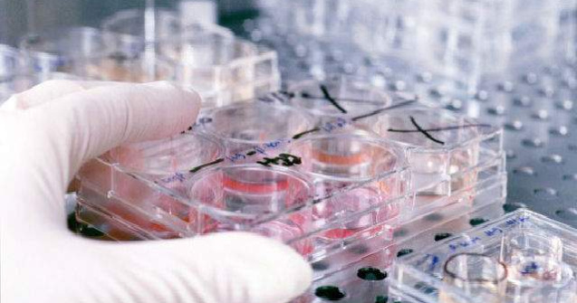  Top  Ce trebuie sa stii despre Ebola, virusul UCIGAS