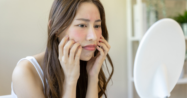 Cum să îngrijești corect tenul cuperozic: 5 recomandări utile