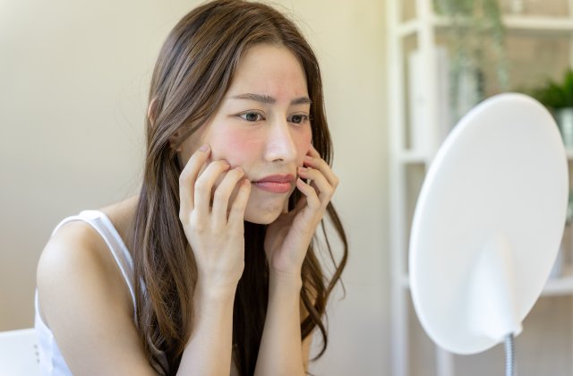 Cum să &icirc;ngrijești corect tenul cuperozic: 5 recomandări utile