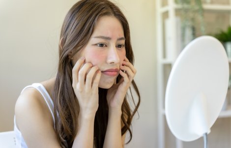 Cum să îngrijești corect tenul cuperozic: 5 recomandări utile