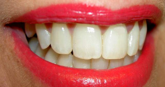  Top  Adevarat sau fals? Miturile despre igiena orala sub lupa expertilor