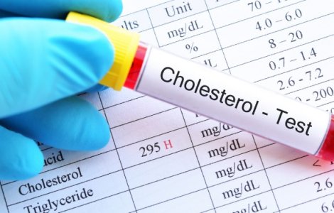 8 Factori de risc pentru nivelul ridicat de colesterol și tratamente recomandate