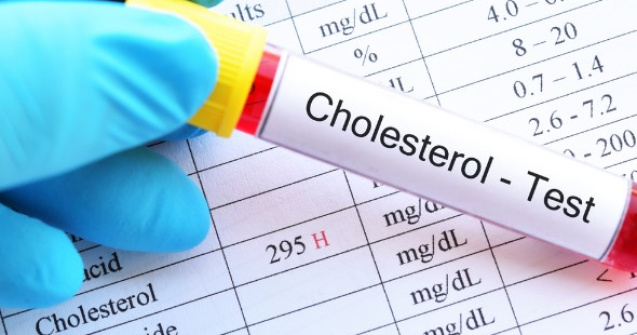 8 Factori de risc pentru nivelul ridicat de colesterol și tratamente recomandate