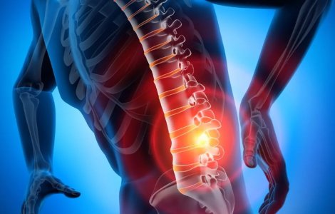 Cum tratăm eficient afecțiunile din zona lombară ?