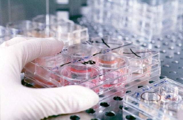 Cromozomul Y influenteaza riscul de cancer al barbatilor