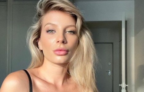 Ana Baniciu, primele declarații despre operația de rinoplastie: „N-am vorbit despre asta până acum”